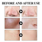 West & Month Blackhead Removing Mud Mask