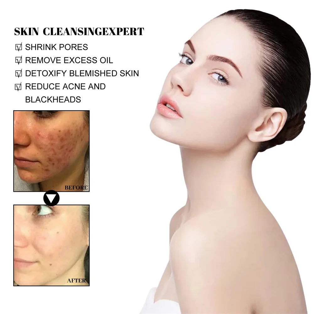 West & Month Blackhead Removing Mud Mask
