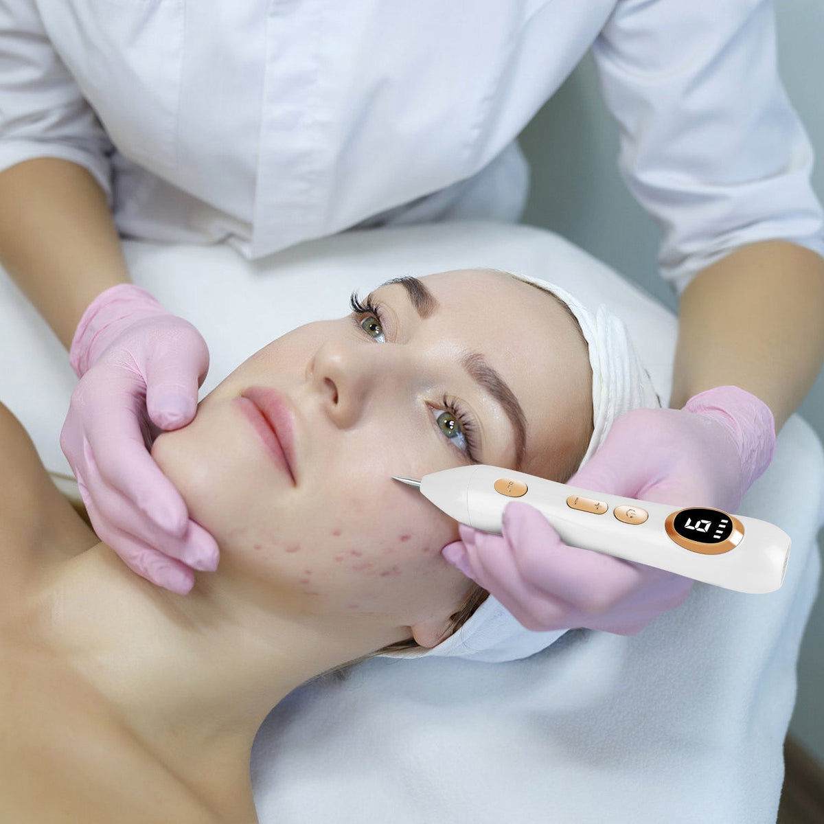 Rechargeable Mole & Wart Remover