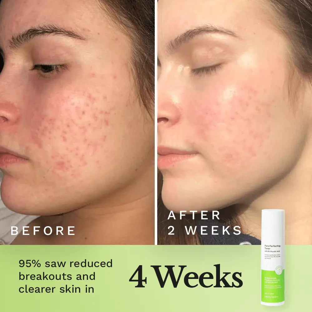 Pore Perfecting Toner