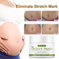Stretch Marks Permanent Removal Cream Maternity Pregnant Women Pregnancy Anti-Winkle Smooth Repair Firming Skin Body Skin Care