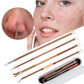 Extractor Vacuum Blackhead Remover